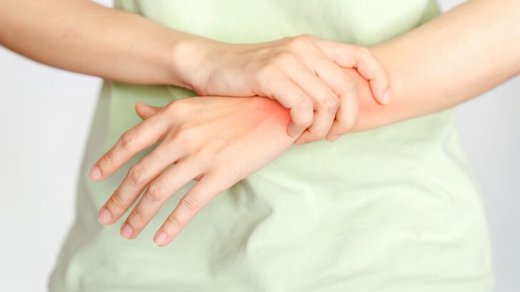 How to Prevent Rheumatoid Arthritis Naturally?